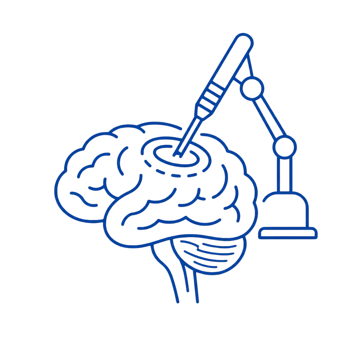 Cirugía cerebral